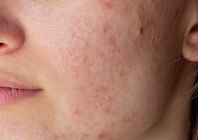 transformation-img-1 transformation-img-1