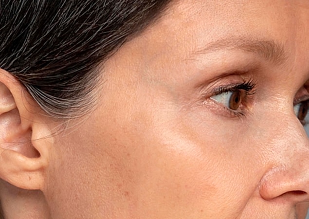 transformation-img-4 transformation-img-4